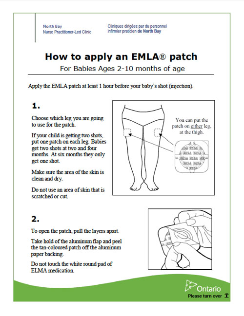 How_To_Apply_An_EMLA_Patch_For_Babies